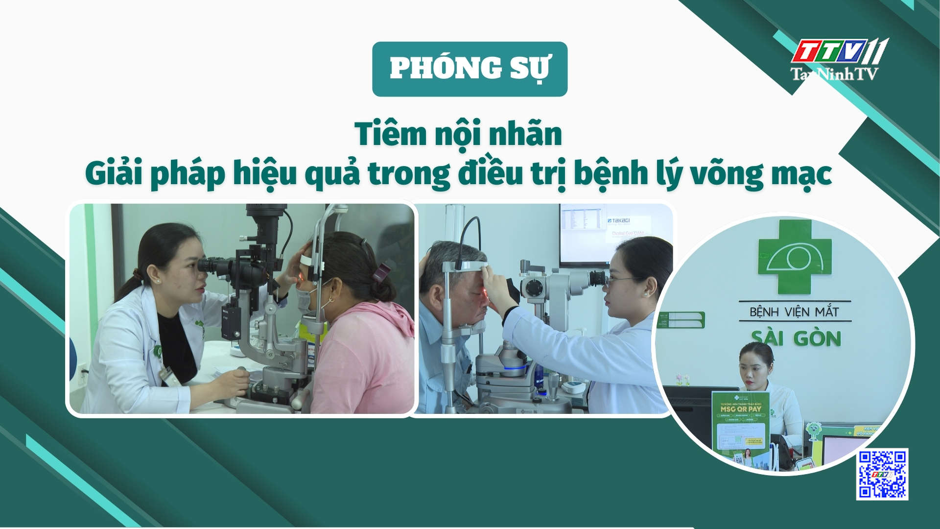 Tiêm nội nhãn - Giải pháp hiệu quả trong điều trị bệnh lý võng mạc | TayNinhTVDVC