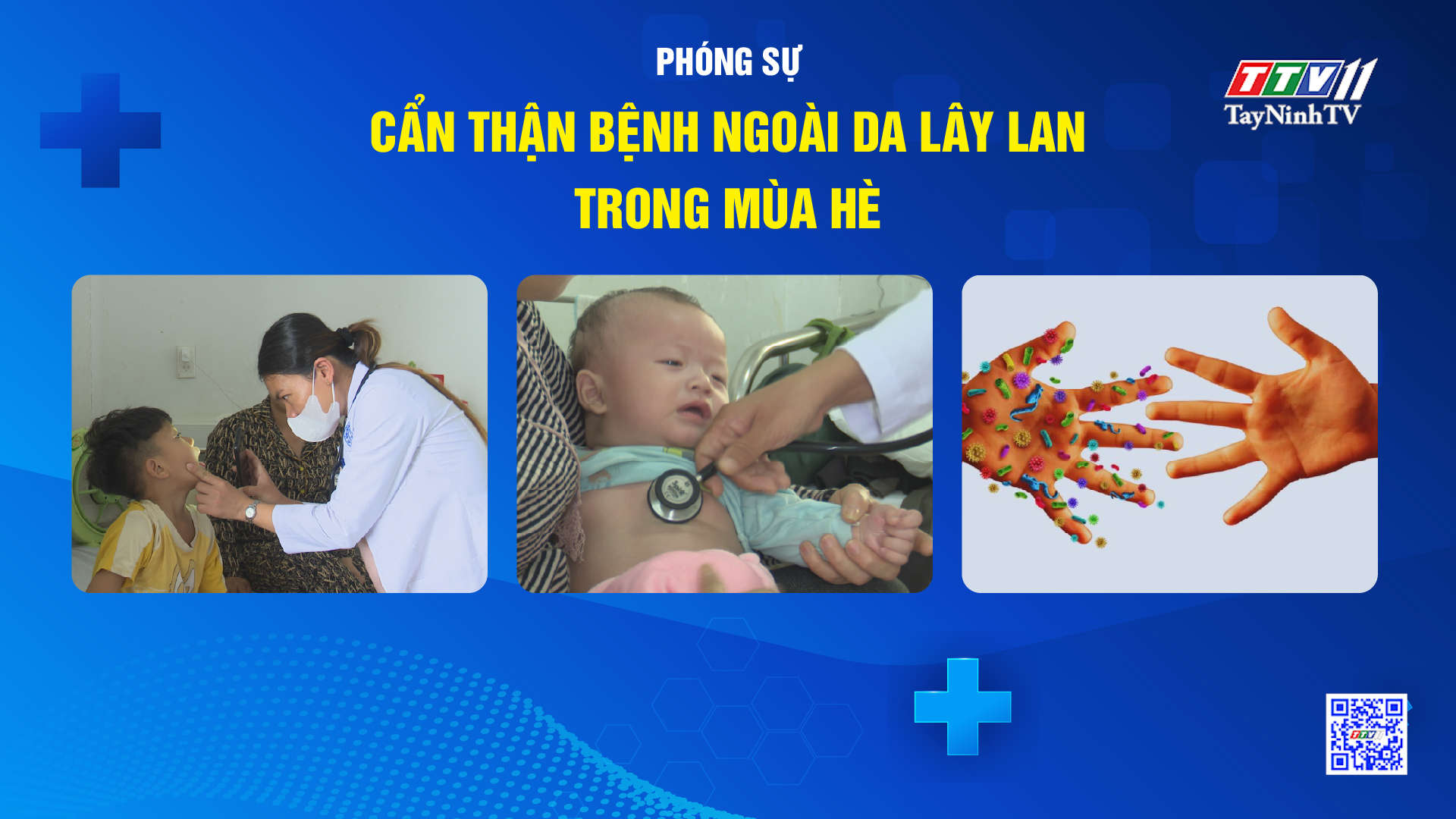 Cẩn thận bệnh ngoài da lây lan trong mùa hè | TayNinhTVDVC